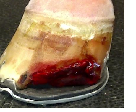 About one fourth of Bruno's hoof was cut away to heal the infection that had brewed for sometime. 